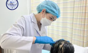 Tốn hàng trăm triệu đồng cấy tóc vẫn hói đầu